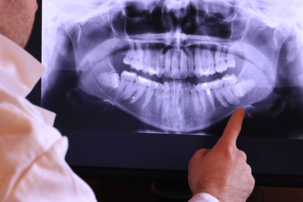 Best Emergency Dental Care for Trauma or Injury in Douglass Hills, KY